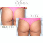 Eximia official (1)